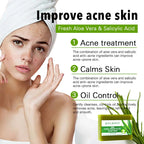 AILKE Aloe Vera Whitening Soap, Remove Acne, Spots, Skin Radiant, Improve Skin Luster, Vegan Bath Wash for All Skin Types, 200g