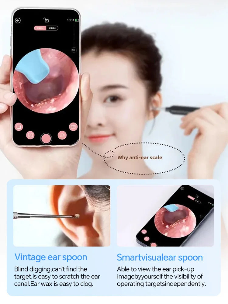 2nd Generation,Digital otoscope,Ear Wax Cleaner Camera,endoscope camera,Earwax Removal Endoscope with Camera,Ear Cleaning Tools