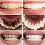 2026 Bestselling Whitening Toothpaste Say Goodbye To Yellow Teeth Oral Hygiene Cleaning and Teeth Care Tool