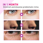 Eye care essence lotion gently cares for the skin around the eyes, providing particle protection, nourishment, and hydration.