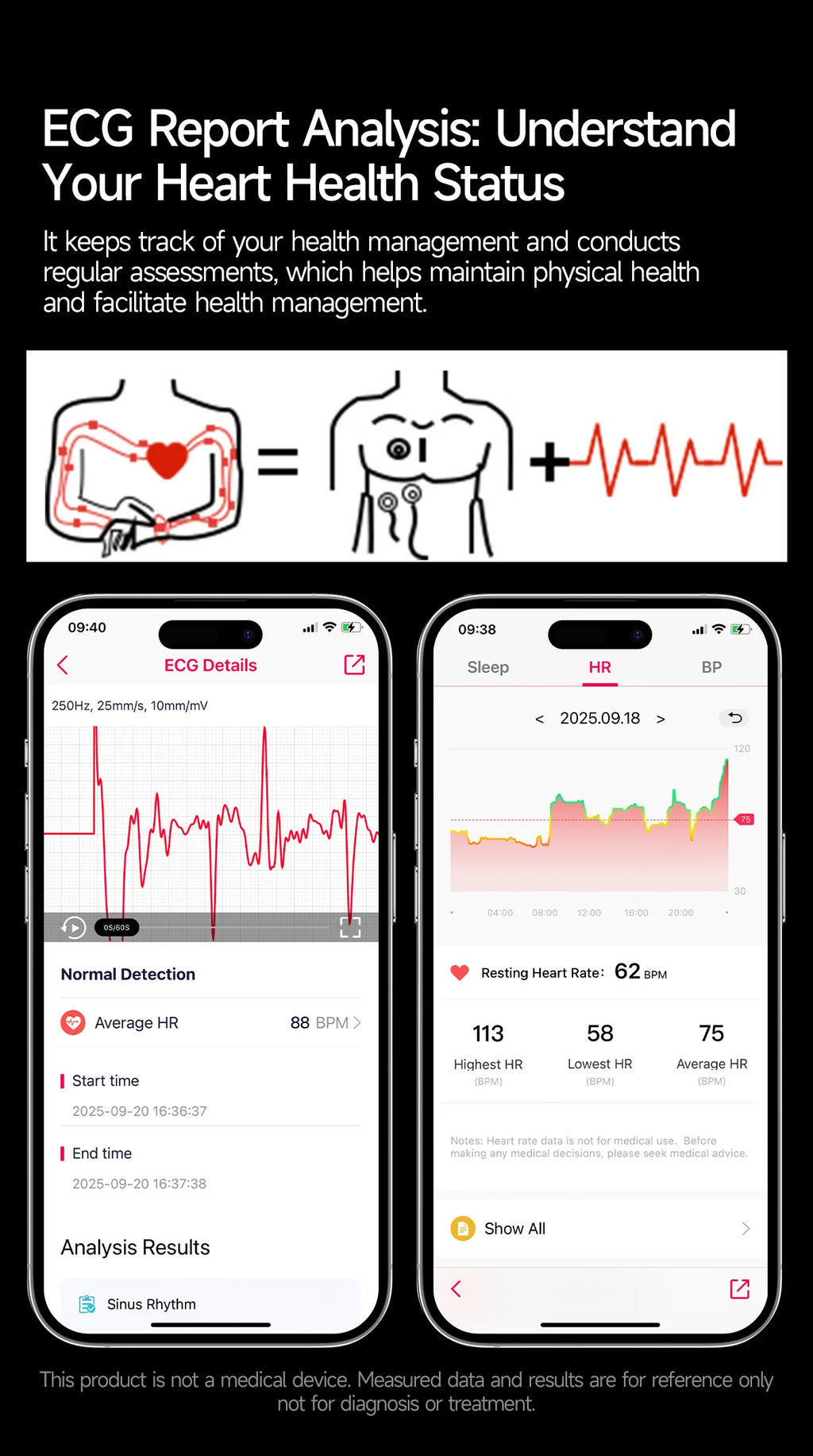 2026New AI-Diagnosis Care Smartwatch ECG+PPG Accurate Uric Acid Blood Pressure Body Fat Five organ Fitness Waterproof Smartwatch