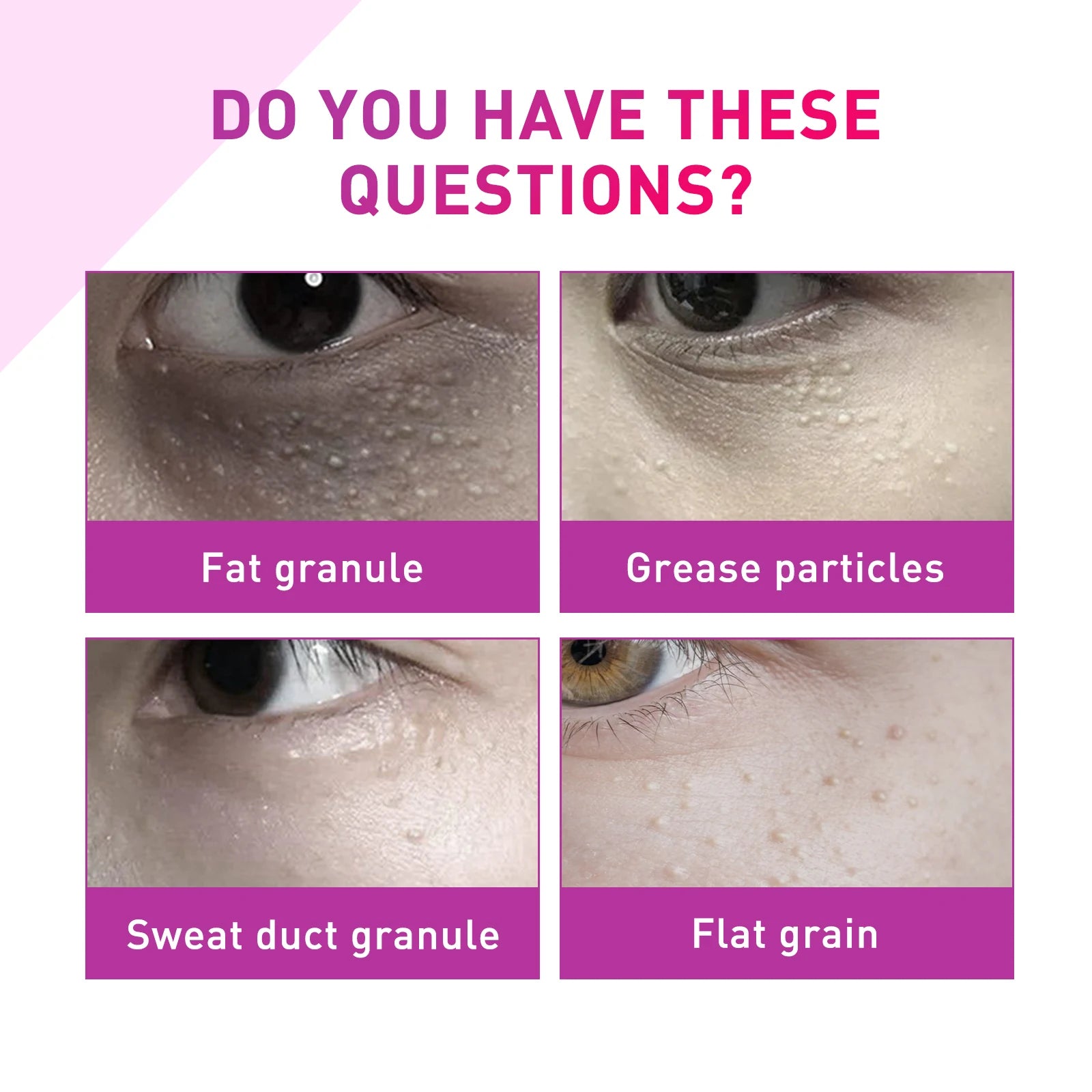 Eye care essence lotion gently cares for the skin around the eyes, providing particle protection, nourishment, and hydration.