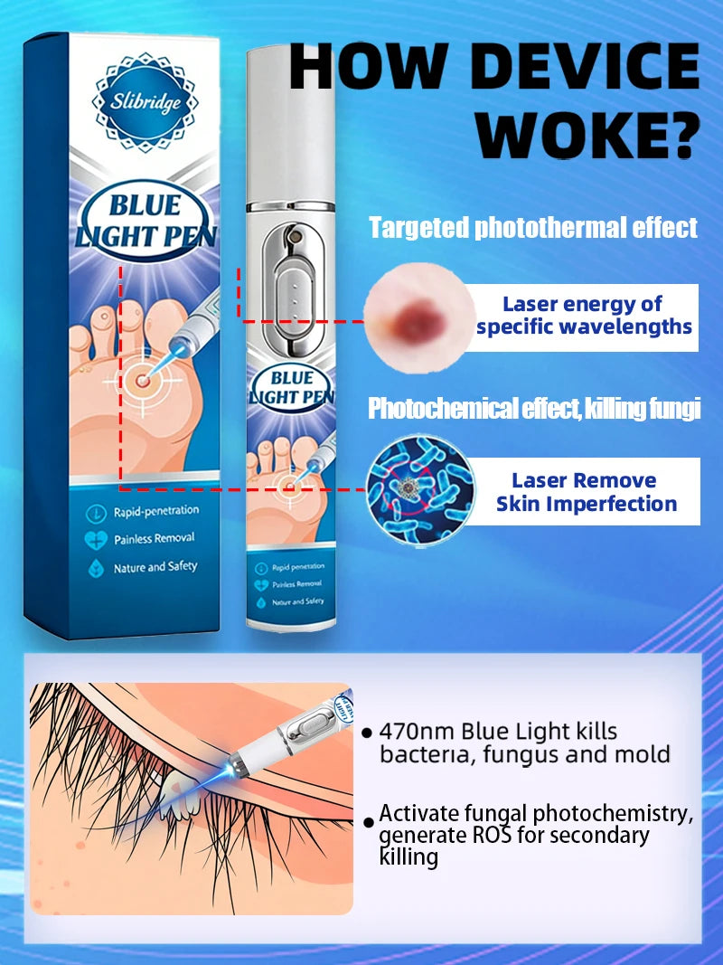 2026NEW blue light pen solve warts, hot sale wart care tools