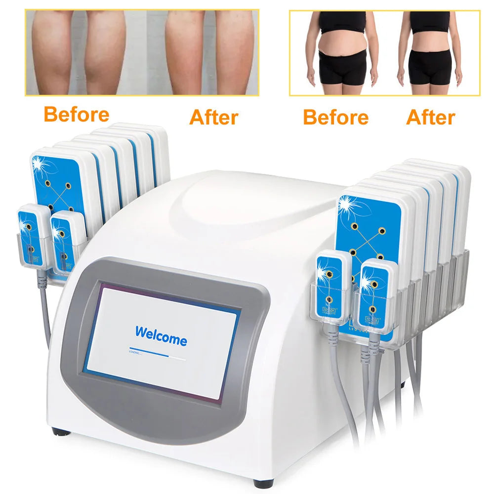 Aristorm 14080mw 635nm-650nm 14 Pads S Shape Machine Body Shape Facial Lifting home appliance body shaping massage equipment