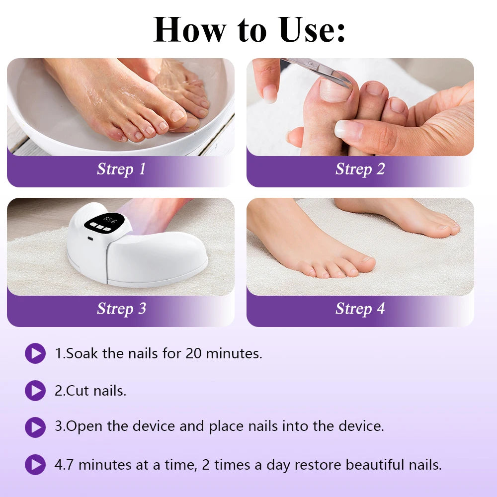 Household Fungal Nail Laser Device Wireless Foot Repair Toenail Fingernail Anti Fungus Infection Paronychia Onychomycosis Care